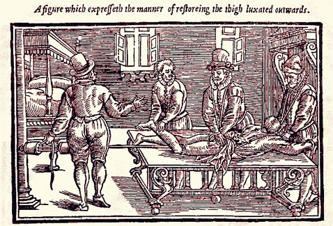 Fixiing a Outwardly Luxated Thigh